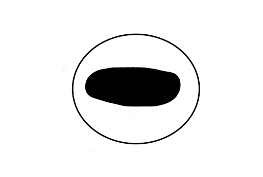 Hier ist vereinfacht ein Auge mit einer waagerechten Pupille dargestellt.